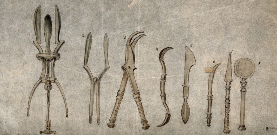 The Sophistication of Ancient Roman Surgical Instruments